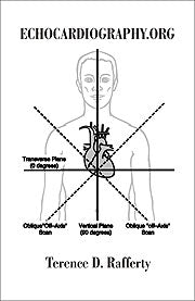 Rafferty, Terence (PBK) Print Edition