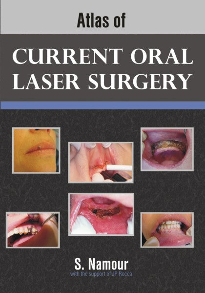 Atlas of Current Oral Laser Surgery (PBK) Print Edition